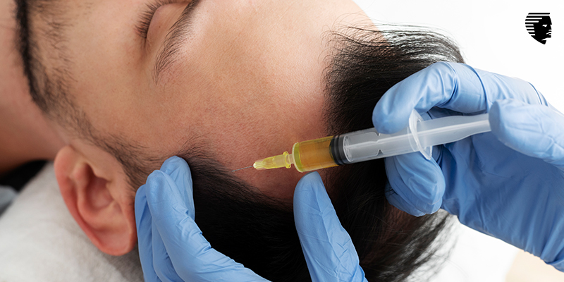 Risks of Receiving a Hair Transplant
