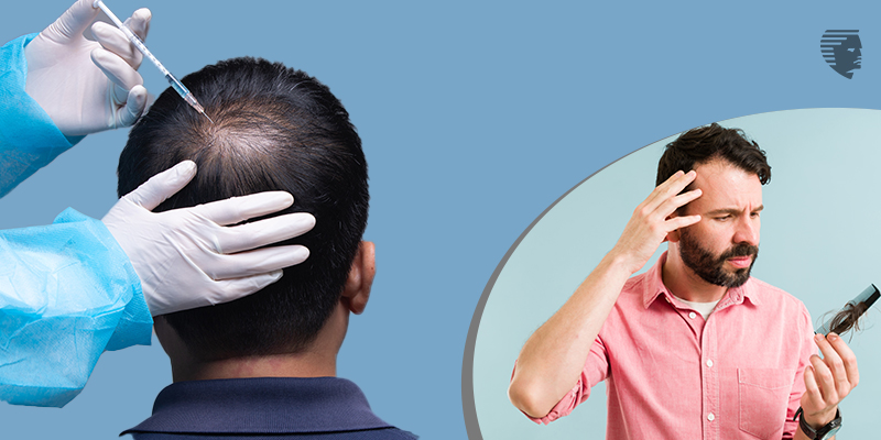 Types of Hair Loss Treatments