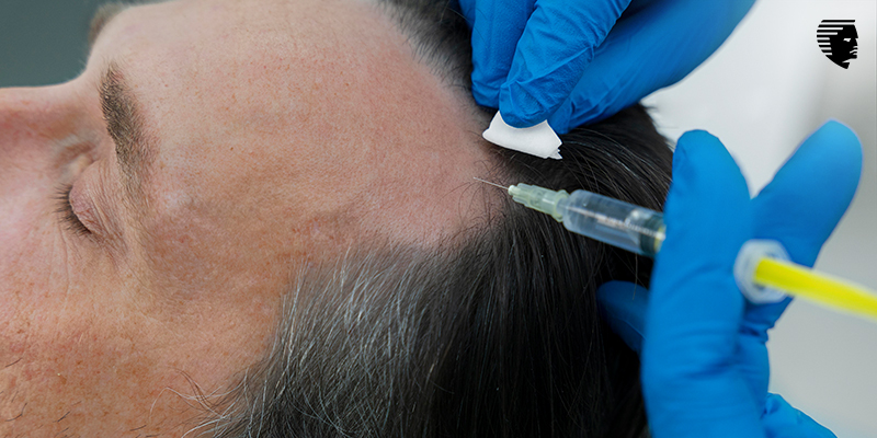 Unveiling the Dark Side of Hair Restoration: Black Market Clinics