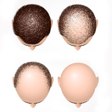 HAIR GROWTH TREATMENT FOR  THE THICK, THE THIN & THE BALD!