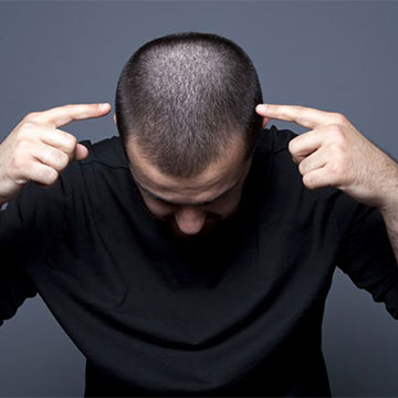 A Better Way to Counter the Hereditary Hair Loss