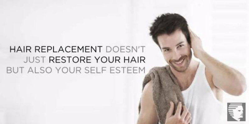 Hair Replacement Doesn't Just Restore Your Hair but Also Your Self Esteem