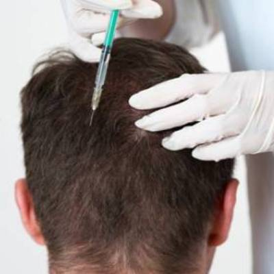 Pros & Cons of Mesotherapy