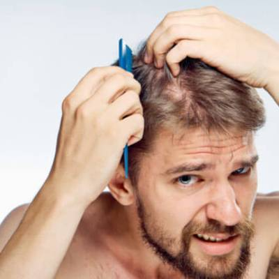 The Effects of Hair Loss tend to be more Noticeable in Men than in Women