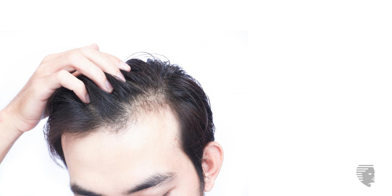 Reasons and Causes for Early Bald | Advanced Hair Studio