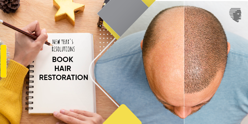 Book your Hair Restoration in 2024: New Year, New You