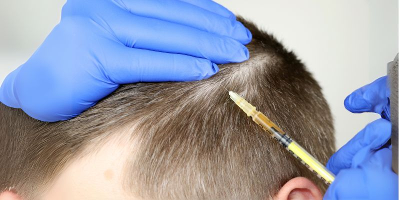 How Mesotherapy Can Help with Hair Loss and Regrowth