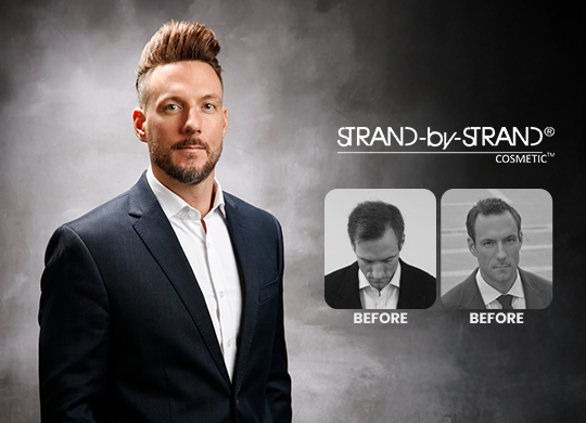 Strand-by-Strand Cosmetic®  